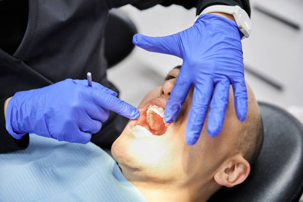 Best Emergency Tooth Extraction in Clearfield, PA